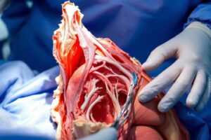 Chirurgie réparatrice des seins tubéreux à Montpellier